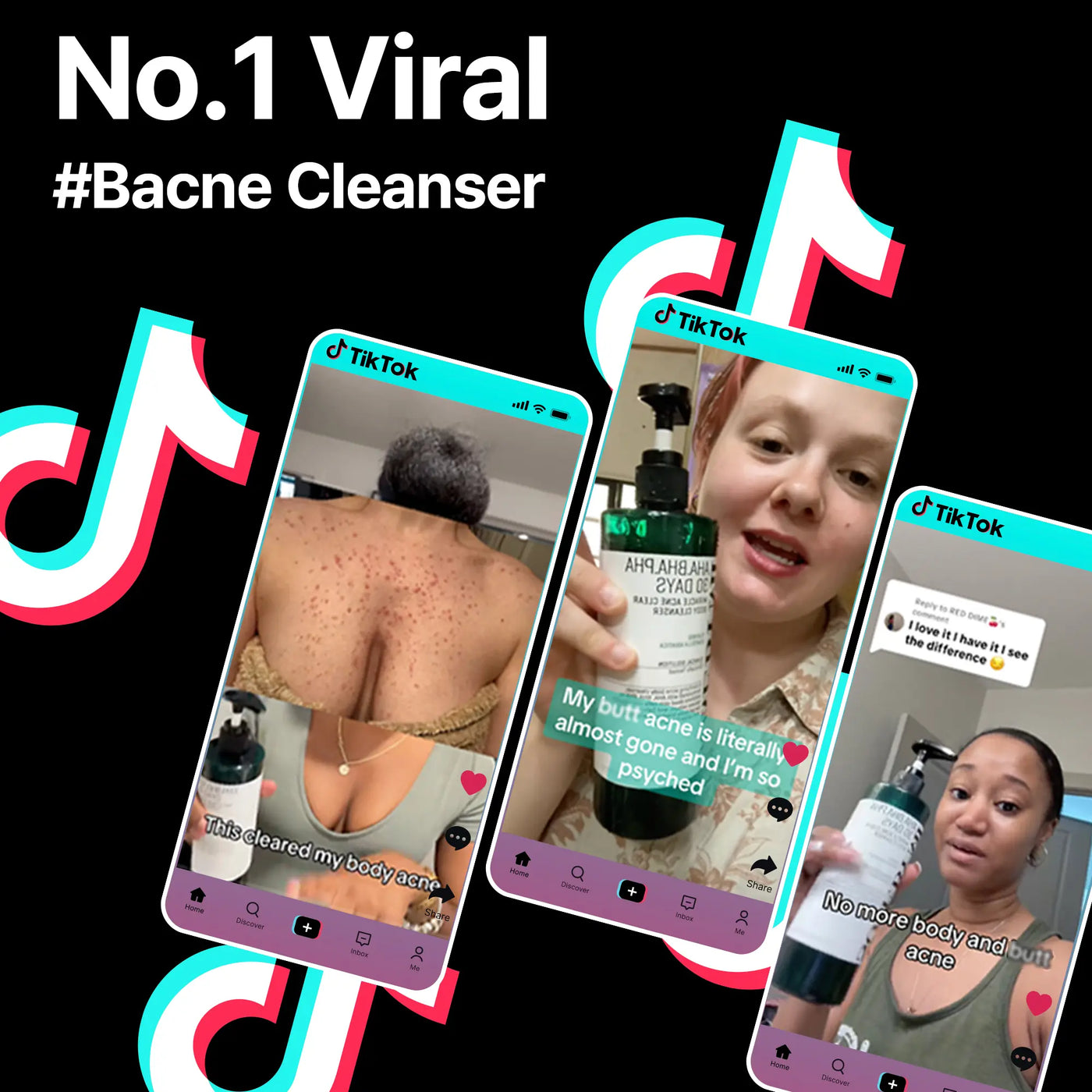 30 Days Miracle Acne Body Cleanser - Image 2